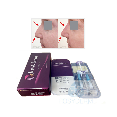 Face Lip Crosslinked Dermal Filler Juvederm Ultra3 Hyaluronic Acid Gel