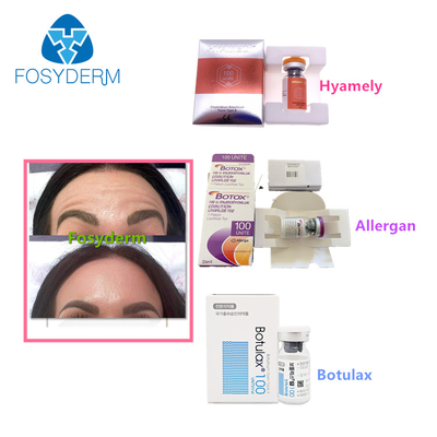 100 Units Type A Botulinum Toxin Allergan Anti Facial Wrinkles  Botulax Injection