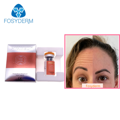 100 Units Type A Botulinum Toxin Allergan Anti Facial Wrinkles  Botulax Injection