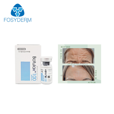 100 Units Type A Botulinum Toxin Allergan Anti Facial Wrinkles  Botulax Injection