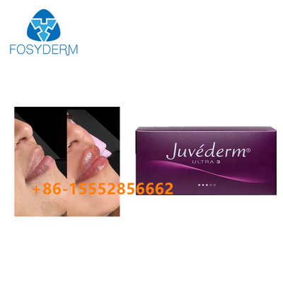 2x1ml Lip Enhancement Juvederm Dermal Filler Cross Linked Hyaluronic Acid Injection