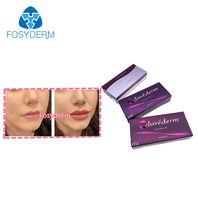 Juvederm 2*1ml Dermal Lip Fillers Cross Linked Hyaluronic Acid Injection For Anti Aging