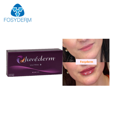 Juvederm 2*1ml Dermal Lip Fillers Cross Linked Hyaluronic Acid Injection For Anti Aging