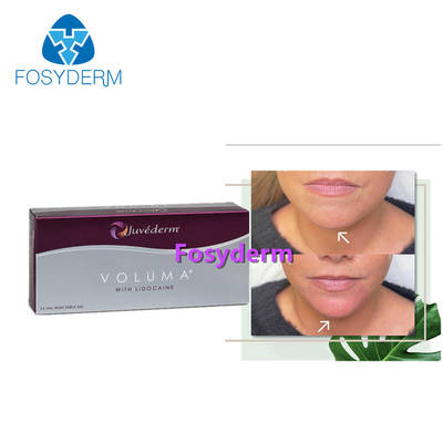Juvederm 2*1ml Dermal Lip Fillers Cross Linked Hyaluronic Acid Injection For Anti Aging