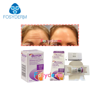100Units Botulinum Anti Wrinkle Toxin Allergan Injection TypeA 