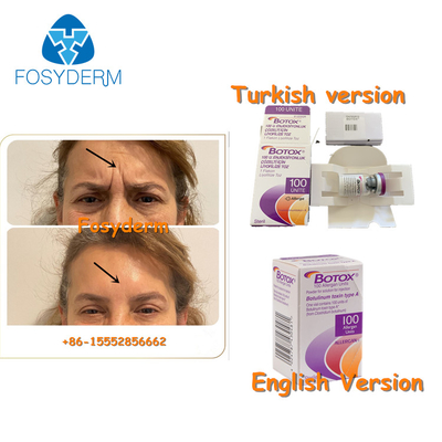 100Units Botulinum Anti Wrinkle Toxin Allergan Injection TypeA Botox