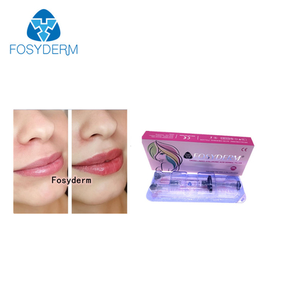 Fosyderm 2ml Dermal Lip Fillers Hyaluronic Acid Lip Enhancement Injection Derm Line