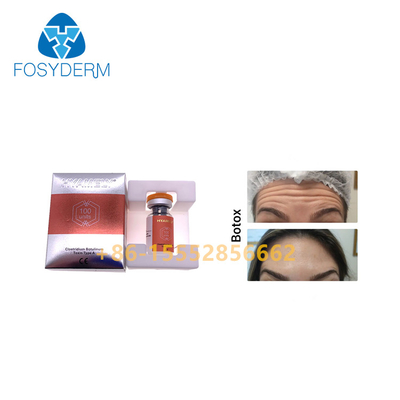 100units TypeA Botulinum Toxin Injection Anti Wrinkles  Allergan