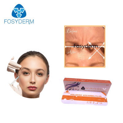 Syringe Packaging Hyaluronic Acid Facial Filler Smooth Texture MOQ 1Box