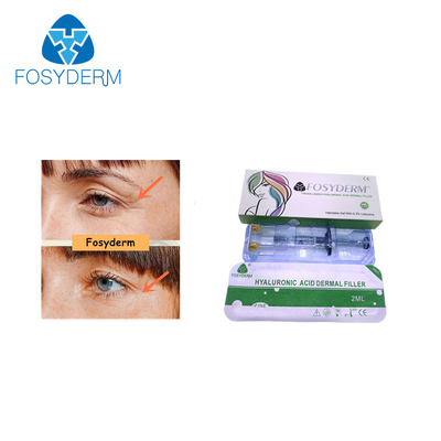 Fosyderm Cross Linked Hyaluronic Acid Dermal Filler For Skin Rejuvenation