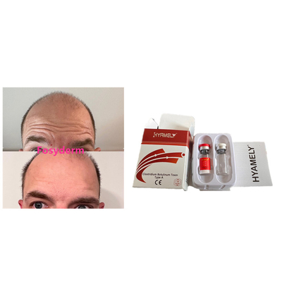 Hyamely 100units Botulinum Toxin Anti Wrinkles New Product  Injection