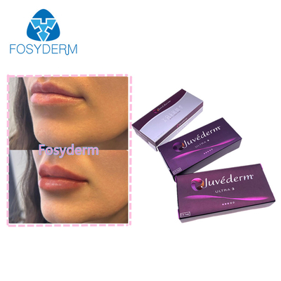 Lips Enhance Dermal Filler 2*1ml Juvederm Hyaluronic Acid Injection