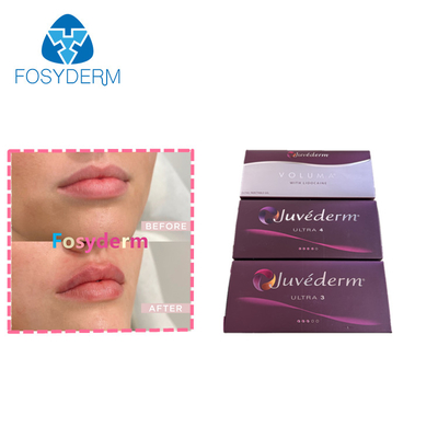 Lips Enhance Dermal Filler 2*1ml Juvederm Hyaluronic Acid Injection