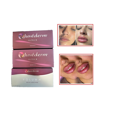 2ml Injections Hyaluronic Acid Facial Filler Juvederm Anti Wrinkle Filler