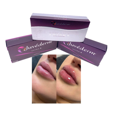 Hyaluronic Acid Dermal Filler 2x1 ML Juvederm Ultra 4 Injectable