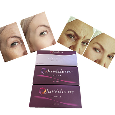 Juvederm Hyaluronic Acid Dermal Filler 2ml Injection Wrinkle Correction