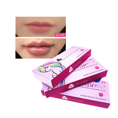 HA Injectable Dermal Filler Fullness Lip Filler Injections Anti Aging