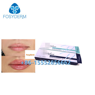 1ml Hyaluronic Acid Dermal Filler Anti Wrinkles Lip Enhancement