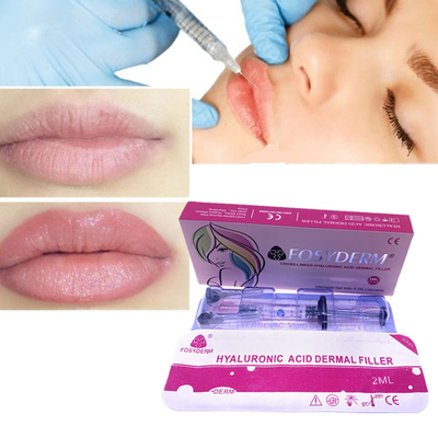 Lip Filler Lip Fullness Enlargement 2ml Dermal Filler Fosyderm HA Filler Injection