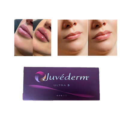 Juvederm Hyaluronic Acid Dermal Filler Anti Wrinkles Facial Lip Filler