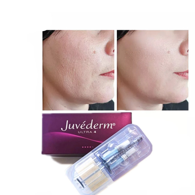 Juvederm Hyaluronic Acid Dermal Filler Anti Aging 2*1ml Face Filler