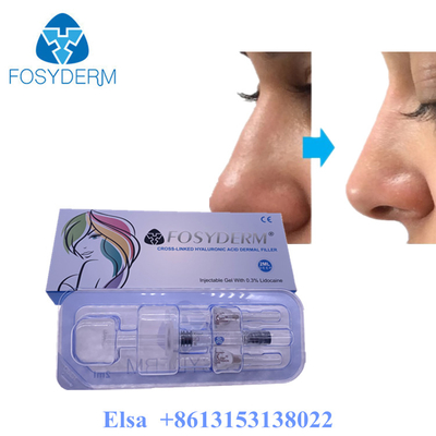Fosyderm Deep 2ml Dermal Filler For Facial Rejuvenation HA Filler
