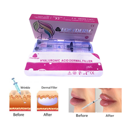 Fosyderm 2ml Hyaluronic Acid Gel Dermal Filler Injections For Facial Nose Skin Care