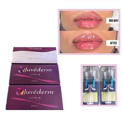 Juvederm Voluma Ultra3 Ultra4 HA Gel Fillers 2 Ml Acid Hyaluronic