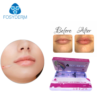 Youthful Glow Subskin Facial Dermal Filler with Hyaluronic Acid