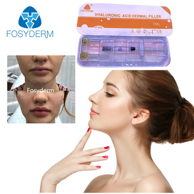 2ml Hyaluronic Acid Dermal Filler For Wrinkle Smoothing On Face Chin Cheek Lips And Body