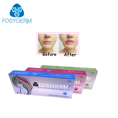 Gel 1ml Hyaluronic Acid Filler For Wrinkle Reduction And Facial Shaping