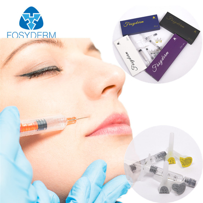 Beauty Care 1ml Hyaluronic Acid Dermal Filler With Lidocaine For Lip Enhancer