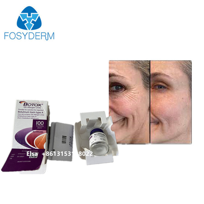  100iu Product Wrinkle Removal Dysport 500