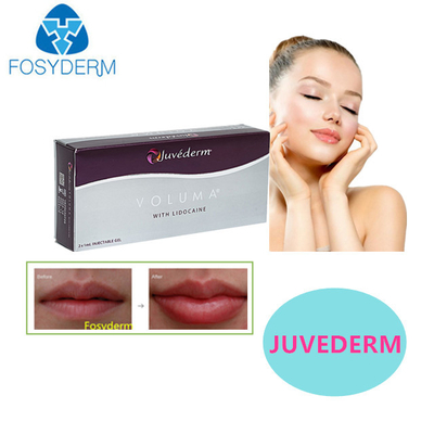 Juvederm Hyaluronic Acid Dermal Filler Sexy Lips 24MG For Face Filler
