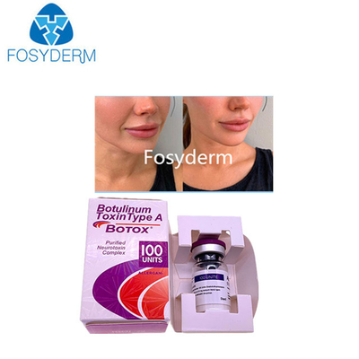 Type A 100 Units Allergan Botulinum Toxin Dermal Filler Hyaluronic Acid