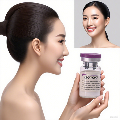 Allergan Injection Botulinum Toxin Anti Wrinkle Dermal Filler for Face and Neck Wrinkle Reduction Solution