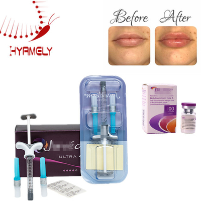 Allergan Injection Botulinum Toxin Anti Wrinkle Dermal Filler for Face and Neck Wrinkle Reduction Solution