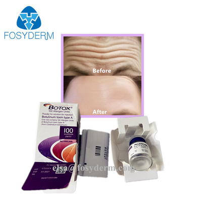 Pure Hot Dermal Fillers Botox Anti Facial Wrinkles Botulinum Toxin 100 Units