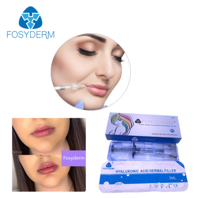 Hyaluronic Acid Dermal Filler 24mg/ml for Face Lips Cheek Chin