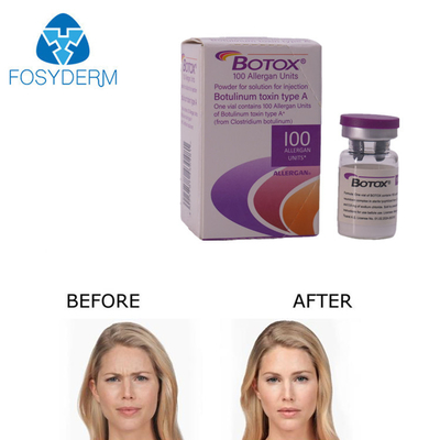 Allergan Botox Injection 100 Units for Wrinkle Removal