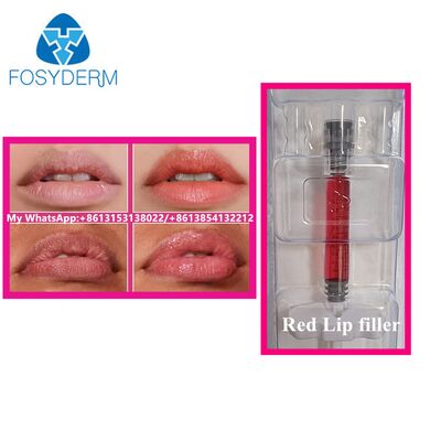 Red Lip Filler with Vitamin B12 Injection Hyaluronic acid Filler Beauty Lip enlargement 1ml