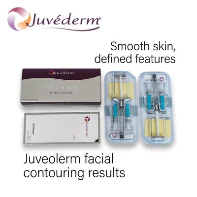 Juvederm HA Filler Lip Enhancement Hyaluronic Acid Dermal Filler Injection