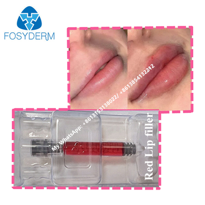 Red Lip Filler With Vitamin B12 Hyaluronic Acid Filler Gel For Lips
