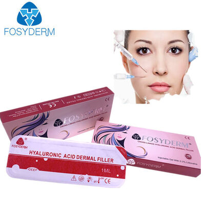 Fosyderm Hyaluronic Acid Dermal Filler lip augmentation
