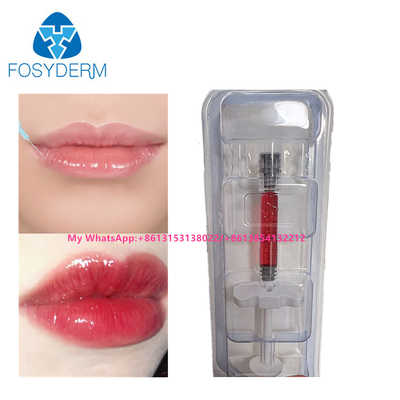 Red Lip Filler Hyaluronic Acid Dermal Filler Injection With Vitamin B12 For Lip 1ml