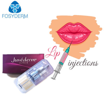 Juvederm Hyaluronic acid dermal filler facial filling 2ml