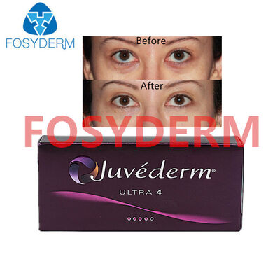 Juvederm Hyaluronic Acid Dermal Filler for Lip & Facial lifting 24mg