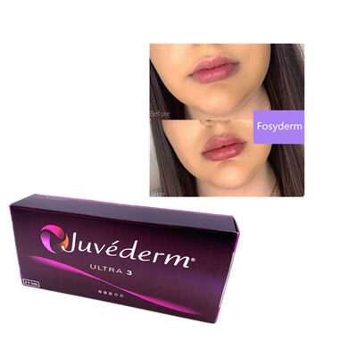 Juvederm Hyaluronic acid dermal filler facial filling Remove Wrinkles