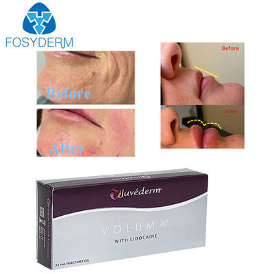 Hyaluronic Acid Dermal Filler Face Lifting Lips Augmentation 2*1ml