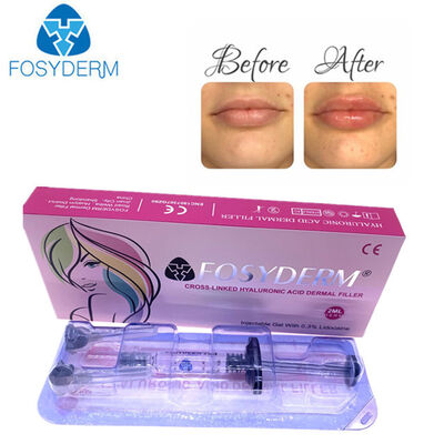 Hyaluronic Acid Dermal Filler Face Lifting 24mg 1ml Derm